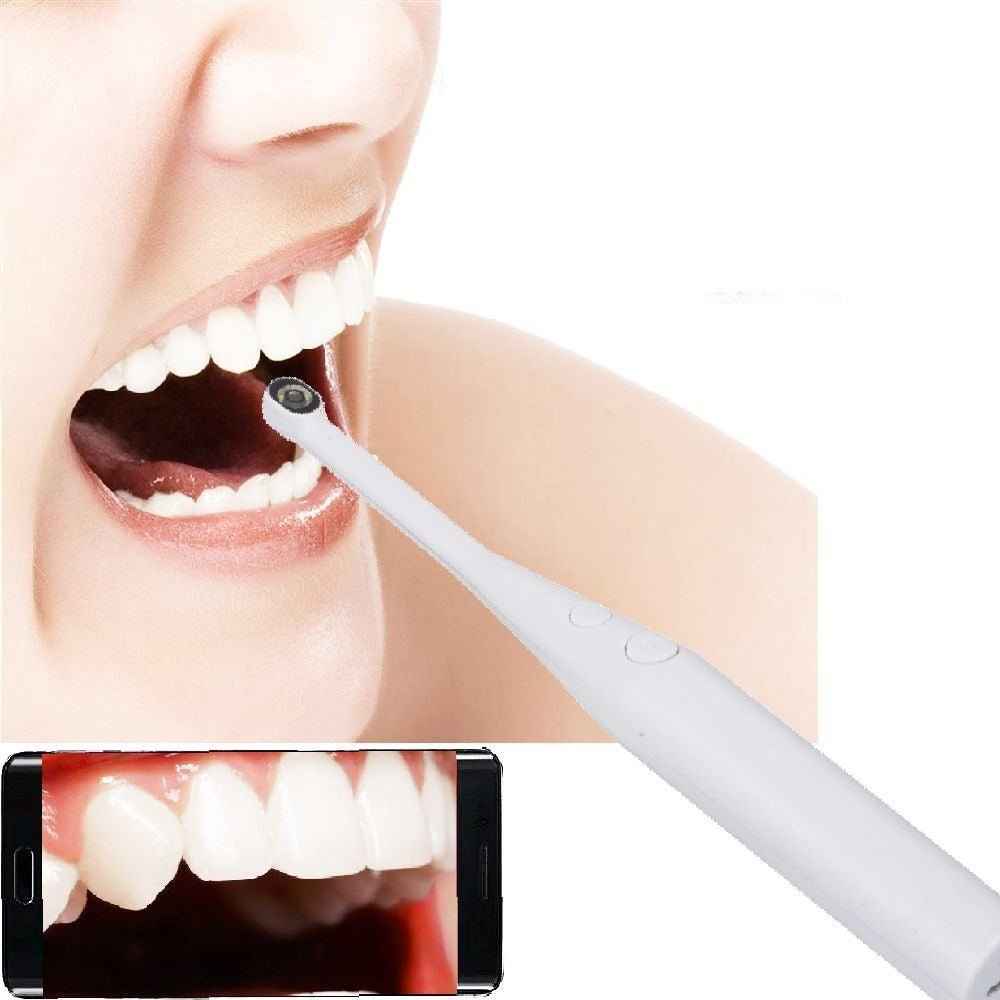 HD USB Dental Camera